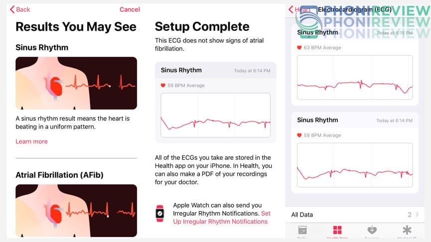 تتبع Apple Health ECG